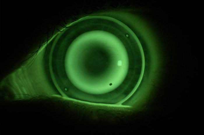 Analisi Visiva Ottica montanari Forlimpopoli