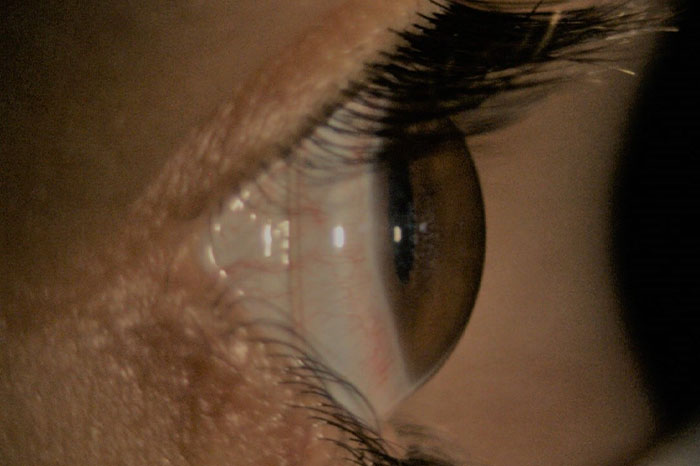 Analisi Visiva Ottica montanari Forlimpopoli